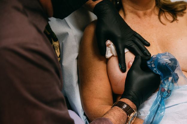 Breast Cancer Survivors Talk About Their Nipple Tattoos